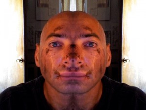 Road Rash 869633829 ec678c3b1f Excuses and a Diversion 300x225 Excuses and a Diversion